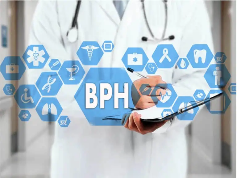 доброкачествена простатна хиперплазия