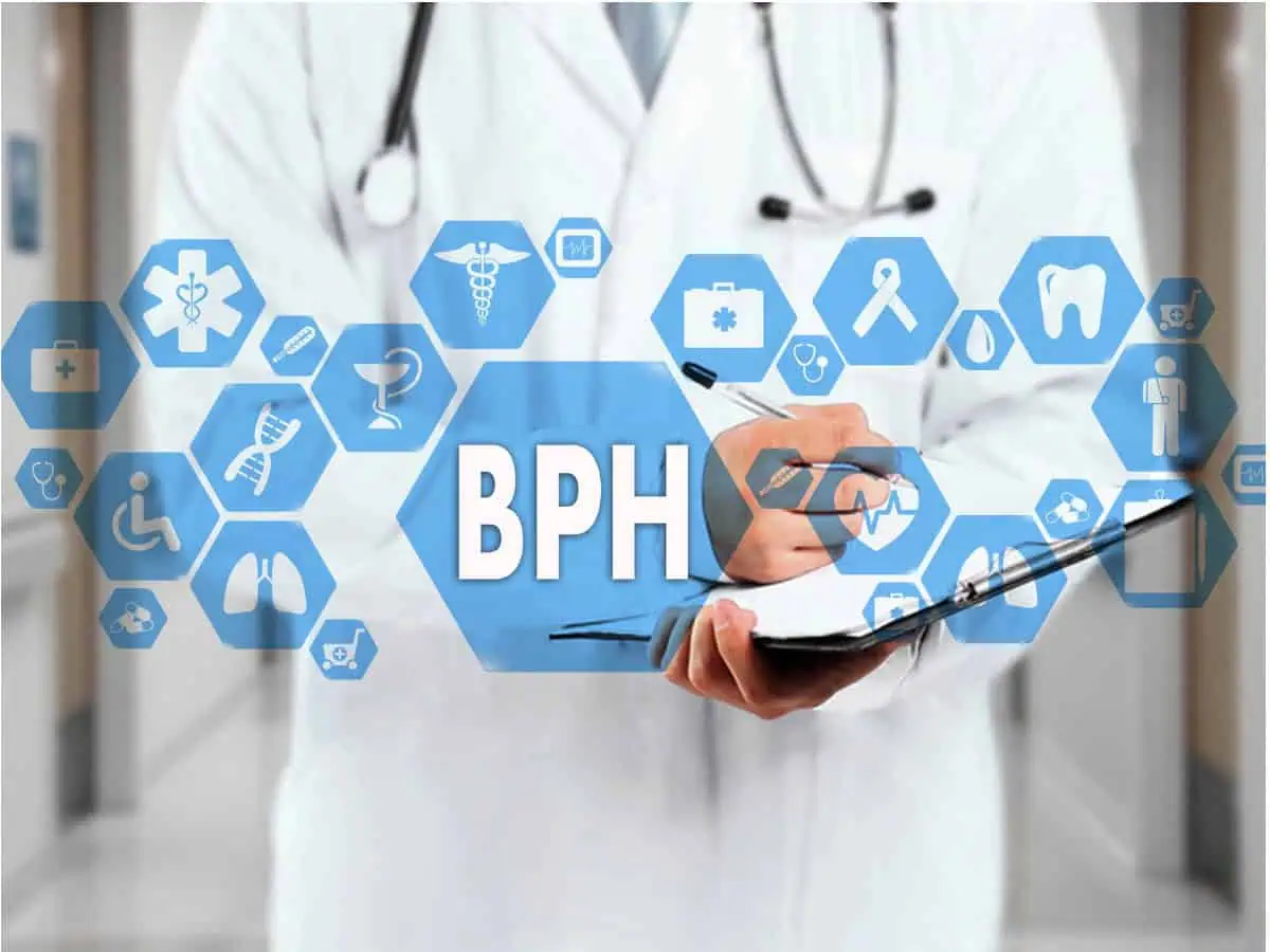 доброкачествена простатна хиперплазия